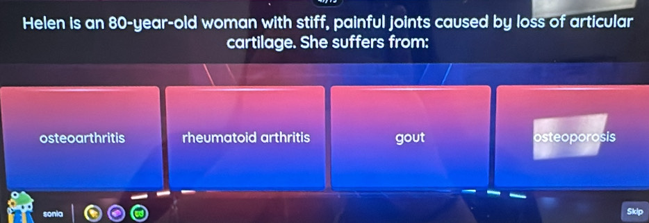 Helen is an 80-year -old woman with stiff, painful joints caused by loss of articular
cartilage. She suffers from:
osteoarthritis rheumatoid arthritis gout osteoporosis
Skip