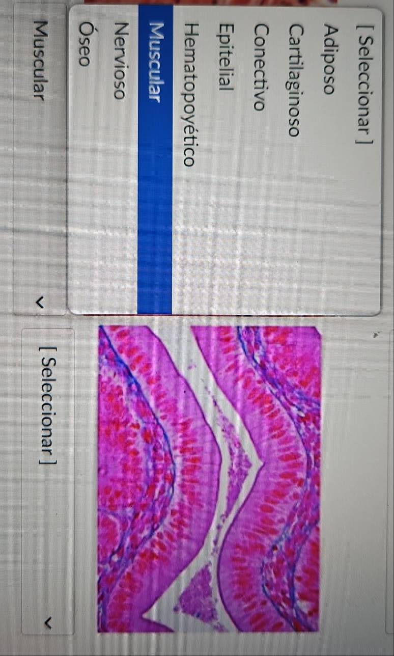 [ Seleccionar ]
Adiposo
Cartilaginoso
Conectivo
Epitelial
Hematopoyético
Muscular
Nervioso
Óseo
Muscular
[ Seleccionar ]