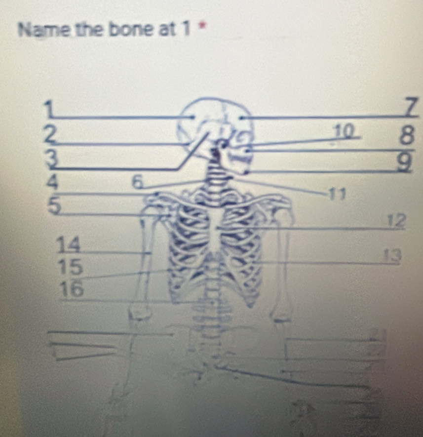 Name the bone at 1 *
7
8
9