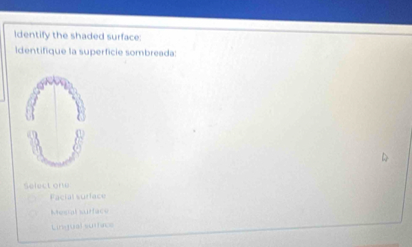 Identify the shaded surface:
Identifique la superficie sombreada:
Select one
Facial surface
Mesial surface
Lingual suífice