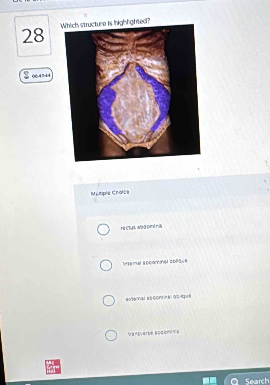 lighted?
00:47:44
Multiple Choice
rectus abdominis
Internal abdominal oblique
external abdominal oblique
transverse abdominis
Search