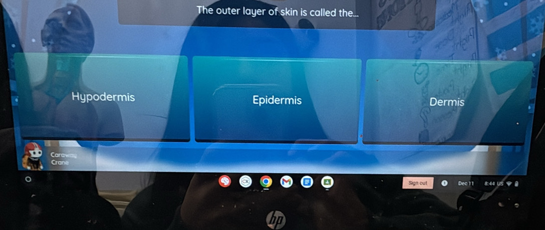 The outer layer of skin is called the...
Hypodermis Epidermis Dermis
Caraway
Crane
Sign out Dec 11