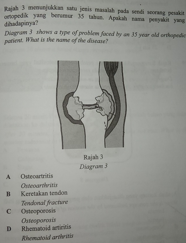 Rajah 3 menunjukkan satu jenis masalah pada sendi seorang pesakit
ortopedik yang berumur 35 tahun. Apakah nama penyakit yang
dihadapinya?
Diagram 3 shows a type of problem faced by an 35 year old orthopedic
patient. What is the name of the disease?
Diagram 3
A Osteoartritis
Osteoarthritis
B Keretakan tendon
Tendonal fracture
C Osteoporosis
Osteoporosis
D Rhematoid artiritis
Rhematoid arthritis