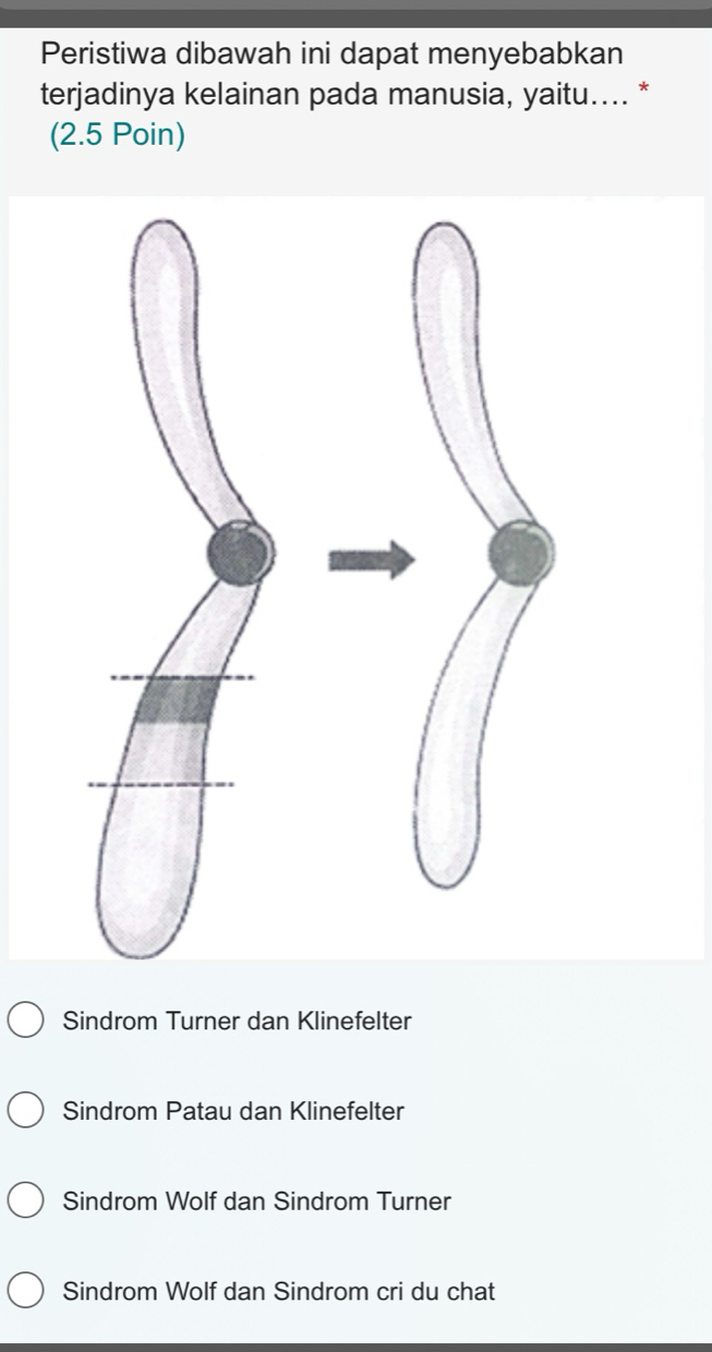 Peristiwa dibawah ini dapat menyebabkan
terjadinya kelainan pada manusia, yaitu.... *
(2.5 Poin)
Sindrom Turner dan Klinefelter
Sindrom Patau dan Klinefelter
Sindrom Wolf dan Sindrom Turner
Sindrom Wolf dan Sindrom cri du chat