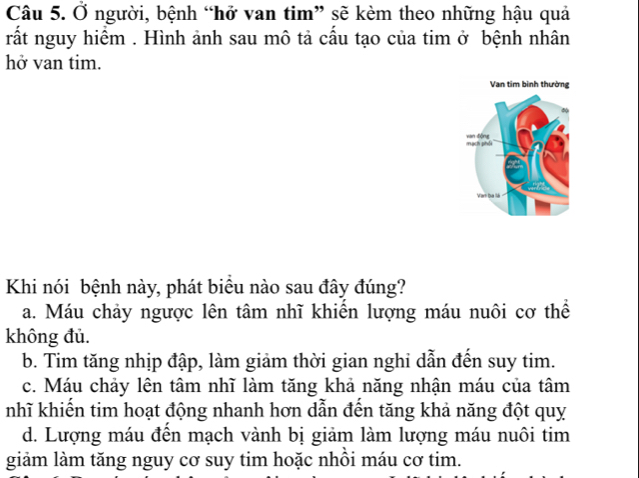 Ở người, bệnh “hở van tim” sẽ kèm theo những hậu quả
rất nguy hiểm . Hình ảnh sau mô tả cầu tạo của tim ở bệnh nhân
hở van tim.
Khi nói bệnh này, phát biểu nào sau đây đúng?
a. Máu chảy ngược lên tâm nhĩ khiến lượng máu nuôi cơ thể
không đủ.
b. Tim tăng nhịp đập, làm giảm thời gian nghi dẫn đến suy tim.
c. Máu chảy lên tâm nhĩ làm tăng khả năng nhận máu của tâm
nhĩ khiến tim hoạt động nhanh hơn dẫn đến tăng khả năng đột quy
d. Lượng máu đên mạch vành bị giảm làm lượng máu nuôi tim
giảm làm tăng nguy cơ suy tim hoặc nhôi máu cơ tim.