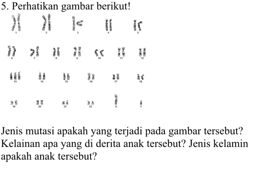 Perhatikan gambar berikut!
2 3 i is 
i 
# fr 
he 
a 14 15
h.C
23
, ,, 
Jenis mutasi apakah yang terjadi pada gambar tersebut? 
Kelainan apa yang di derita anak tersebut? Jenis kelamin 
apakah anak tersebut?