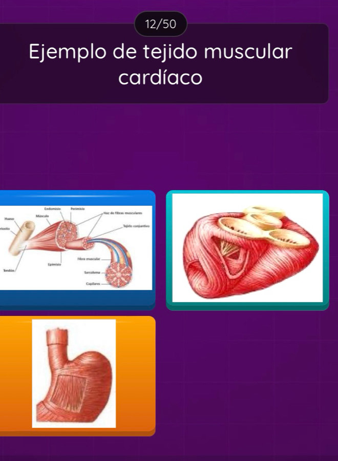 12/50 
Ejemplo de tejido muscular 
cardíaco 
I