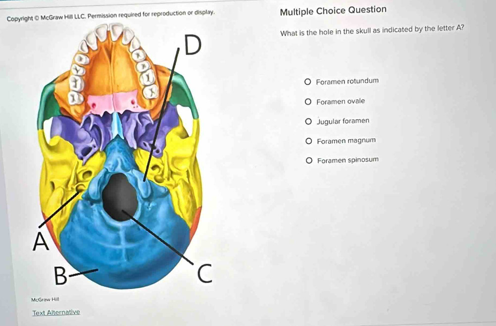 Copyri Permission required for reproduction or display. Multiple Choice Question
What is the hole in the skull as indicated by the letter A?
Foramen rotundum
Foramen ovale
Jugular foramen
Foramen magnum
Foramen spinosum
McGraw Hill
Text Alternative