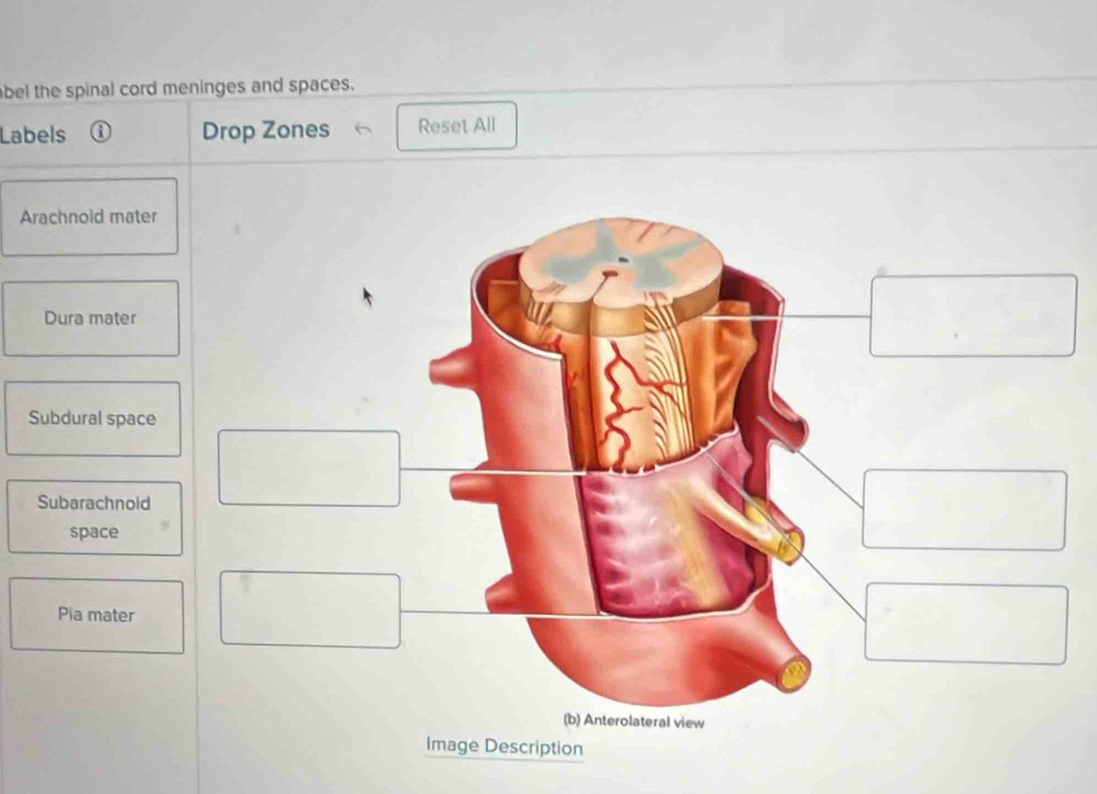 bel the spinal cord meninges and spaces. 
Labels Drop Zones Reset All 
Arachnold mater 
Dura mater 
Subdural space 
Subarachnoid 
space 
Pia mater 
(b) Anterolateral view 
Image Description