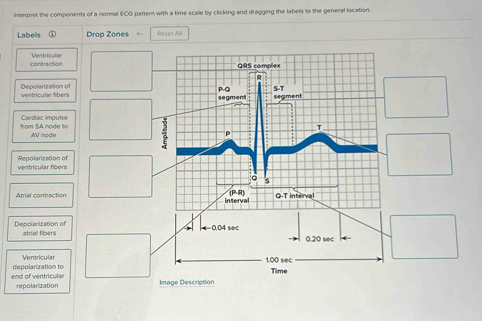 Solved: Interpret the components of a normal ECG pattern with a time ...