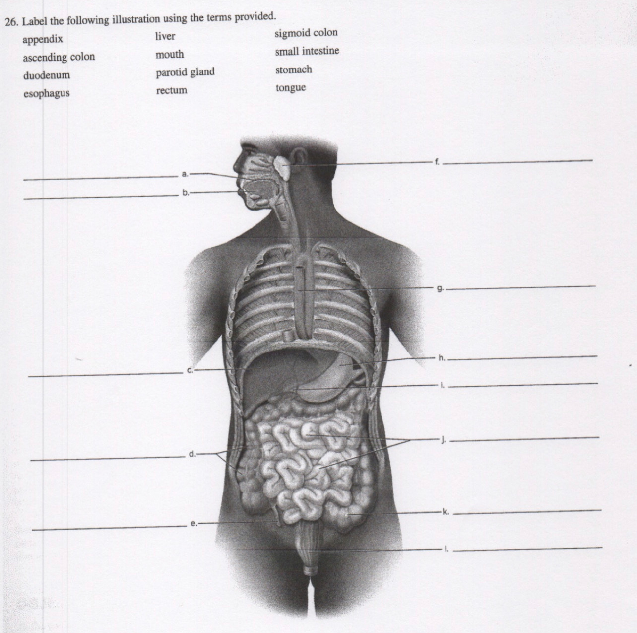 Label the following illustration using the terms provided.
appendix liver sigmoid colon
ascending colon mouth small intestine
duodenum parotid gland stomach
esophagus rectum tongue