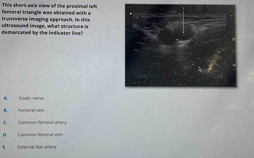 This short-axis view of the proximal left
femoral triangle was obtained with a
transverse imaging approach. In this
ultrasound image, what structure is
demarcated by the indicator line?
.II
A. Sciatic nerve
B. Femoral vein
C. Common femoral artery
D. Common femoral vein
E. External iliac artery