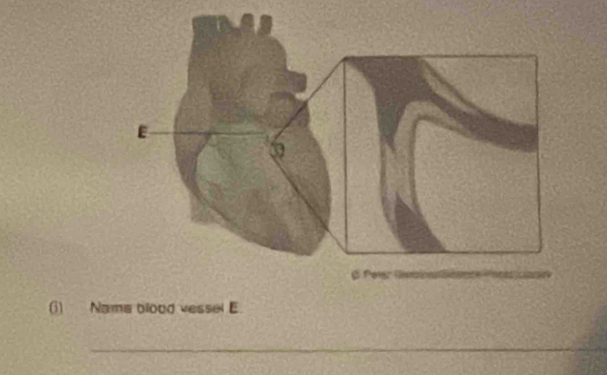 () Nama blood vessel E. 
_ 
_