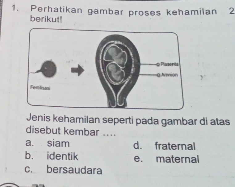 Perhatikan gambar proses kehamilan 2
berikut!
Jenis kehamilan seperti pada gambar di atas
disebut kembar ....
a. siam d. fraternal
b. identik e. maternal
c. bersaudara