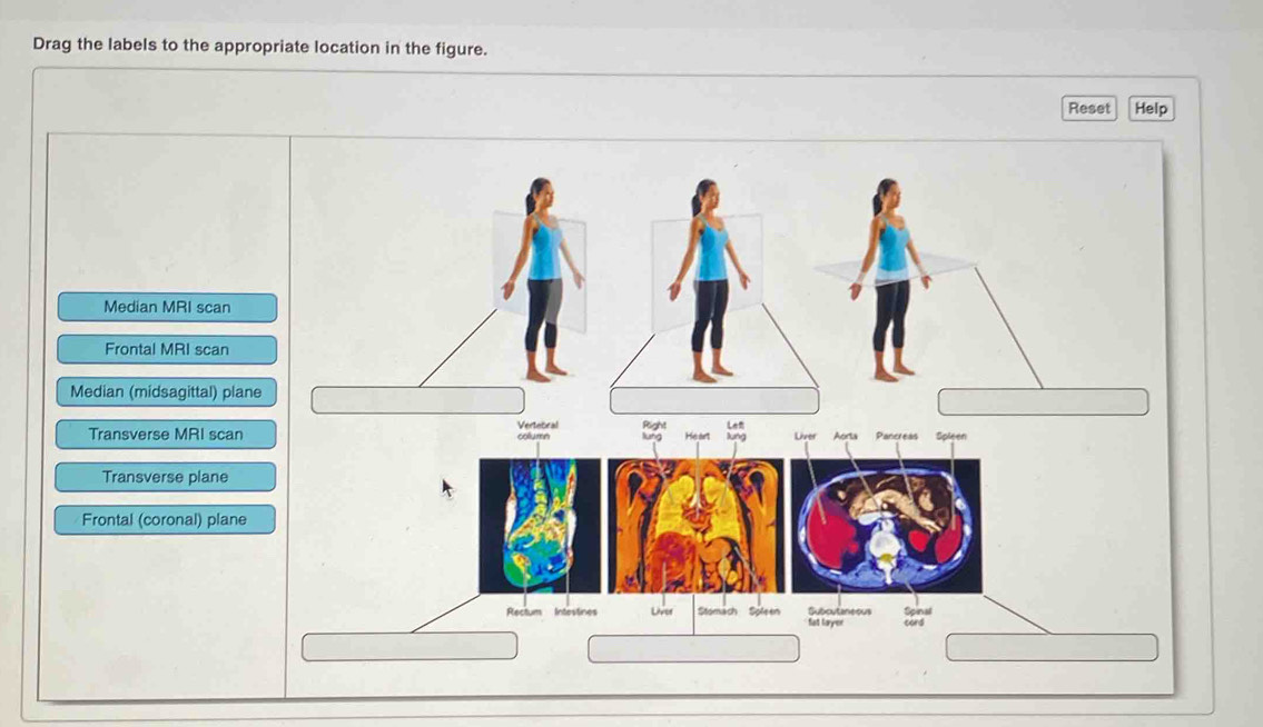 Solved: Drag the labels to the appropriate location in the figure ...