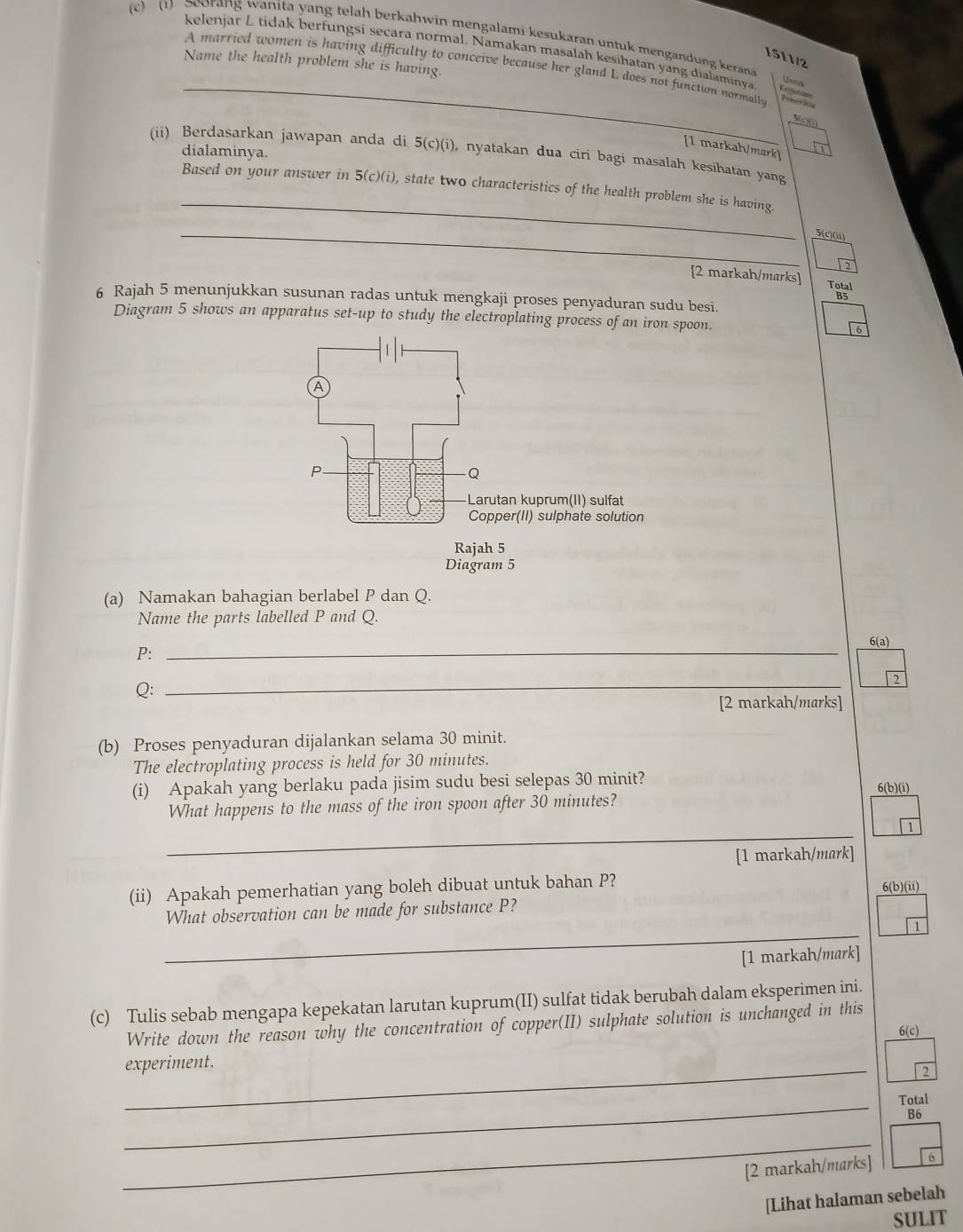 (1) Seorang wanita yang telah berkahwin mengalami kesukaran untuk mengandung keran
kelenjar L tidak berfungsí secara normal. Namakan masalah kesihatan yang dialaminya Lena
1511/2
A married women is having difficulty to conceive because her gland L does not function normally
Name the health problem she is having.  
[1 markah/mark]
dialaminya.
(ii) Berdasarkan jawapan anda di 5(c)(i), nyatakan dua ciri bagi masalah kesihatan yang
_
Based on your answer in 5(c)(i), state two characteristics of the health problem she is having
_
5(c)(i)
_
[2 markah/marks] Total
B5
6 Rajah 5 menunjukkan susunan radas untuk mengkaji proses penyaduran sudu besi.
Diagram 5 shows an apparatus set-up to study the electroplating process of an iron spoon. 6
Diagram 5
(a) Namakan bahagian berlabel P dan Q.
Name the parts labelled P and Q.
6(a)
P:_
Q:
_
2
[2 markah/marks]
(b) Proses penyaduran dijalankan selama 30 minit.
The electroplating process is held for 30 minutes.
(i) Apakah yang berlaku pada jisim sudu besi selepas 30 minit? 6(b)(i)
What happens to the mass of the iron spoon after 30 minutes?
_
[1 markah/mark]
(ii) Apakah pemerhatian yang boleh dibuat untuk bahan P? 6(b)(ii)
_
What observation can be made for substance P?
1
[1 markah/mark]
(c) Tulis sebab mengapa kepekatan larutan kuprum(II) sulfat tidak berubah dalam eksperimen ini.
Write down the reason why the concentration of copper(II) sulphate solution is unchanged in this
6(c)
_experiment.
2
_
Total
B6
_
[2 markah/marks] 6
[Lihat halaman sebelah
SULIT