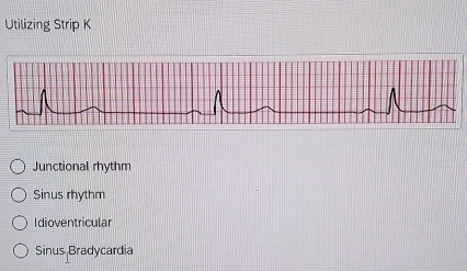 Utilizing Strip K
Junctional rhythm
Sinus rhythm
Idioventricular
Sinus Bradycardia