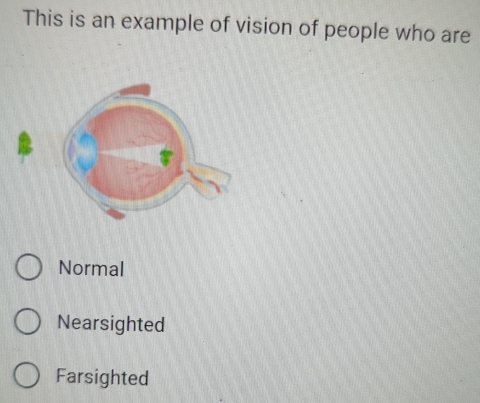 This is an example of vision of people who are
Normal
Nearsighted
Farsighted