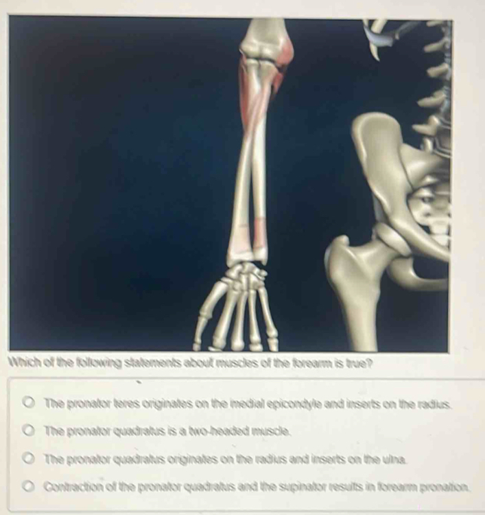Solved: The pronator teres originates on the medial epicondyle and ...