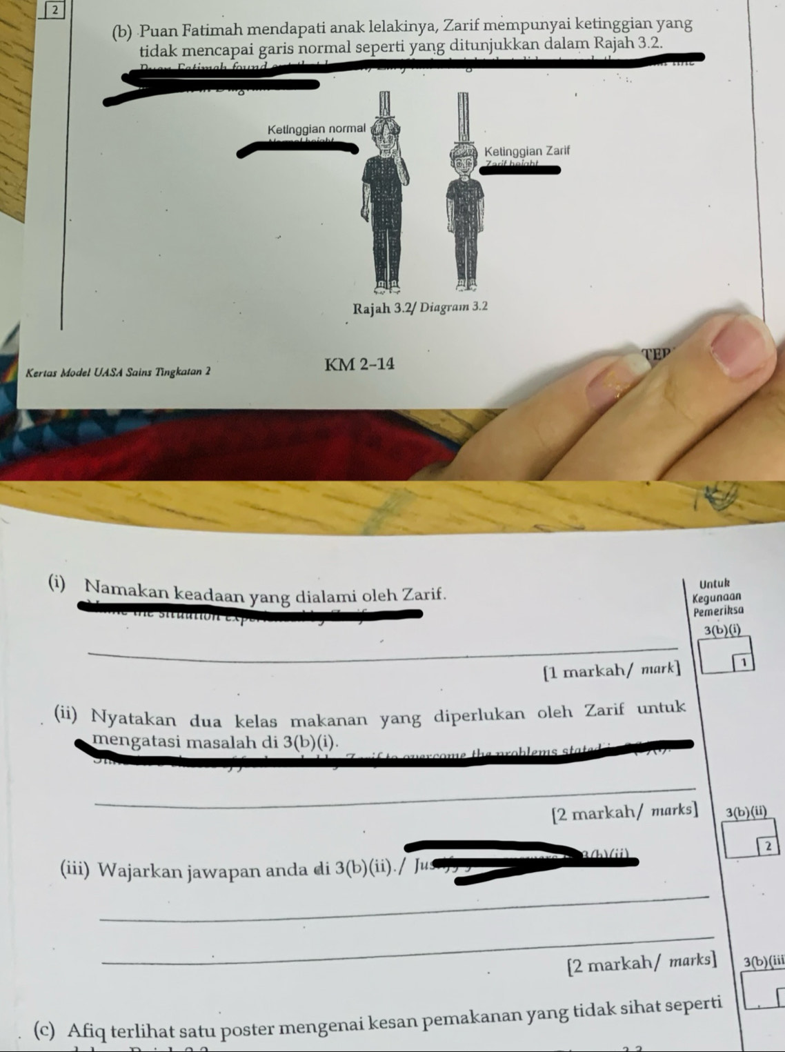 2 
(b) Puan Fatimah mendapati anak lelakinya, Zarif mempunyai ketinggian yang 
tidak mencapai garis normal seperti yang ditunjukkan dalam Rajah 3.2. 
Kertas Model UASA Sains Tingkatan 2 KM 2-14 TEp 
(i) Namakan keadaan yang dialami oleh Zarif. 
Untuk 
Kegunaan 
Pemeriksa
3(b)(i)
_ 
[1 markah/mark] 1 
(ii) Nyatakan dua kelas makanan yang diperlukan oleh Zarif untuk 
_ 
mengatasi masalah di 3(b)(i). 
oblems states 
_ 
[2 markah/ marks] 3(b)(ii)
3(h)(ii) 
2 
(iii) Wajarkan jawapan anda di 3 (b)(ii)./ Jus 
_ 
_ 
[2 markah/ marks] 3(b)(iii 
(c) Afiq terlihat satu poster mengenai kesan pemakanan yang tidak sihat seperti