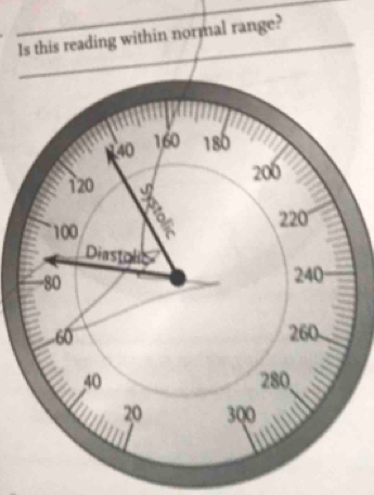 Is this reading within normal range?