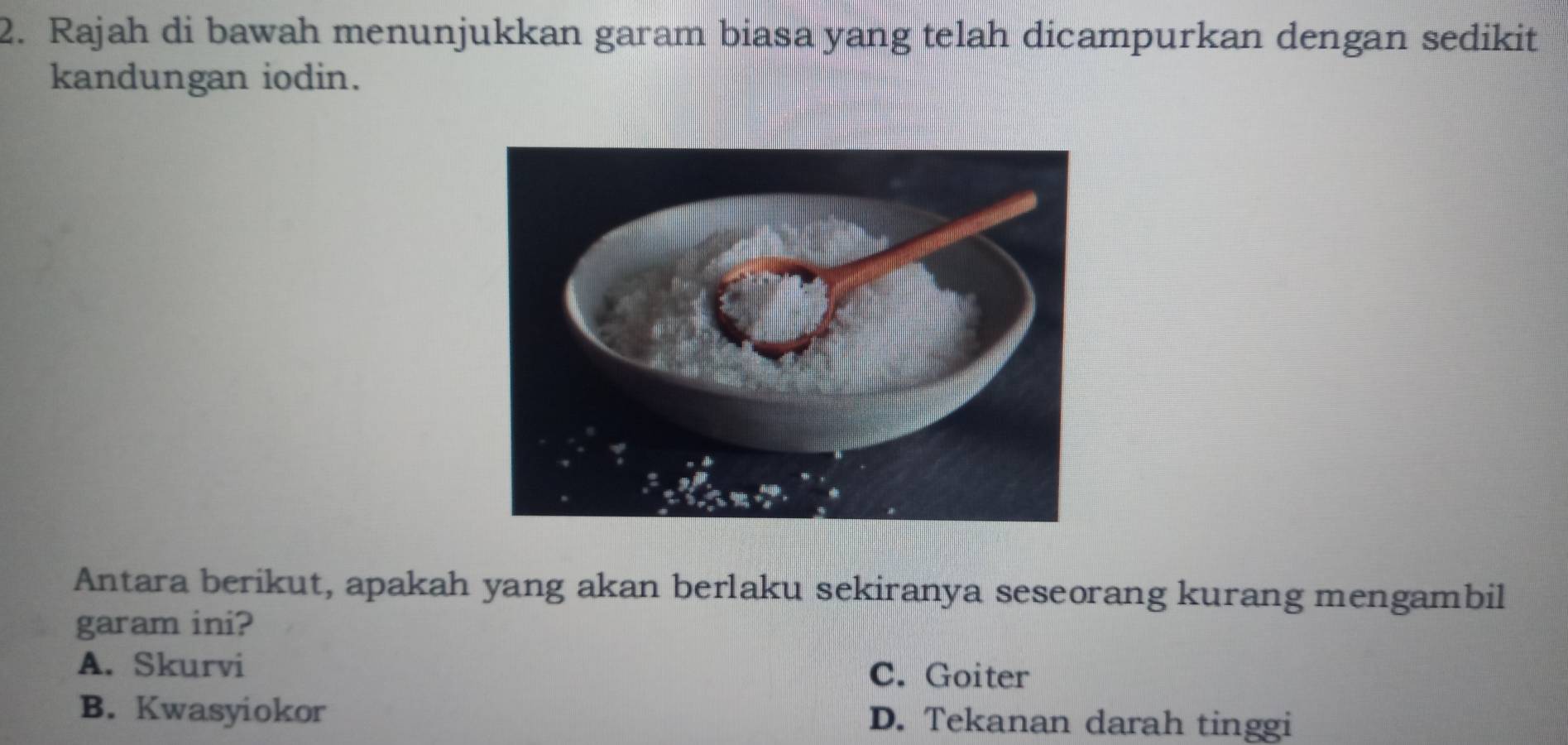 Rajah di bawah menunjukkan garam biasa yang telah dicampurkan dengan sedikit
kandungan iodin.
Antara berikut, apakah yang akan berlaku sekiranya seseorang kurang mengambil
garam ini?
A. Skurvi C. Goiter
B. Kwasyiokor D. Tekanan darah tinggi