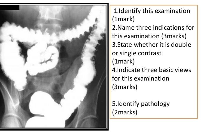 Identify this examination 
mark) 
Name three indications for 
is examination (3marks) 
State whether it is double 
single contrast 
mark) 
ndicate three basic views 
this examination 
marks) 
Identify pathology 
marks)