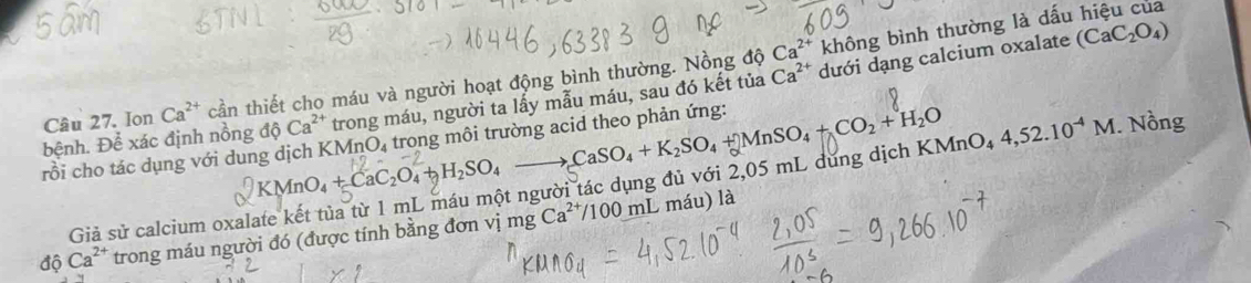 Ca^(2+) không bình thường là dấu hiệu của 
Câu 27. Ion Ca^(2+) cần thiết cho máu và người hoạt động bình thường. Nồng độ Ca^(2+) dưới dạng calcium oxalate
(CaC_2O_4)
dhat oCa^(2+) trong máu, người ta lấy mẫu máu, sau đó kết tủa 
bệnh. Để xác định nồng rồi cho tác dụng với dung dịch KMnO₄ trong môi trường acid theo phản ứng: to CaSO_4+K_2SO_4+MnSO_4+CO_2+H_2O
H_2SO_4
Giả sử calcium oxalate kết tủa từ 1 mL máu một người tác dụng đủ với 2,05 mL dừng dịch KMnO4 4,52.10^(-4)M. Nồng 
độ Ca^(2+) trong máu người đó (được tính bằng đơn v 7 mgCa^(2+)/100m
L máu) là