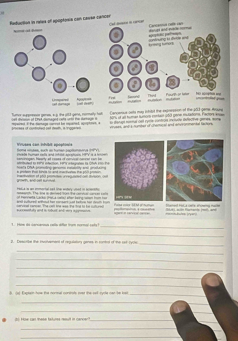 Reduction in rates of apoptosis can cause cancer
Cell division in cancer
Cancerous cells can
disrupt and evada normal
apoptotic pathways,
continuing to divide and
farming tumors.
a°
e°
a°
First Second Third Fourth or later No apoptsis and
mutation mutation mutation mutation uncontrolled growe 
Tumor suppressor genes. e.g. the p53 gene, normally halt Cancerous cells may inhibit the expression of the p53 gene. Around
cell division of DNA damaged cells until the damage is 50% of all human tumors contain p53 gene mutations. Factors knowm
repaired. If the damage cannot be repaired, apoptosis, a to disrupt normal cell cycle controls include defective genes, some
process of controlled cell death, is triggered. viruses, and a number of chemical and environmental factors.
Viruses can inhibit apoptosis
Some viruses, such as human papillomavirus (HPV).
invade human cells and inhibit apoptosis. HPV is a known
carcinogen. Nearly all cases of cervical cancer can be
attributed to HPV infection. HPV integrates its DNA into the
host's DNA promoting genomic instability and producing
a protein that binds to and inactivates the p53 protein.
Inactivation of p53 promotes unregulated cell division, cell
growth, and cell survival.
HeLa is an immortal cell line widely used in scientific
research. The line is derived from the cervical cancer cells
of Henrietta Lacks (HeLa celis) after being taken from her 
and cultured without her consent just before her death from
cervical cancer. The cell line was the first to be cultured False color SEM of human Stained HaLa cells showing nucle
successfully and is robust and very aggressive. papillomavirus, a causative microtubules (cyan) (blus), actin filaments (red), and
agent in cervical cancer.
_
1. How do cancerous cells differ from normal cells?
_
_
2. Describe the involvement of regulatory genes in control of the cell cycle:
_
_
_
_
_
3. (a) Explain how the normal controls over the cell cycle can be lost:_
_
_
_
_
_
(b) How can these failures result in cancer?_
_
_
_
_