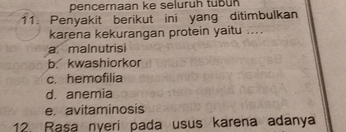 pencernaan ke seluruh tubüh
11. Penyakit berikut ini yang ditimbulkan
karena kekurangan protein yaitu ...
a. malnutrisi
b. kwashiorkor
c. hemofilia
d. anemia
e. avitaminosis
12. Rasa nyeri pada usus karena adanya