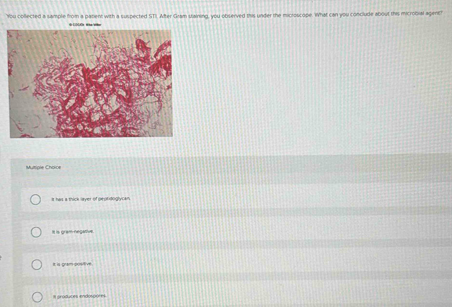 Solved: You collected a sample from a patient with a suspected STI ...