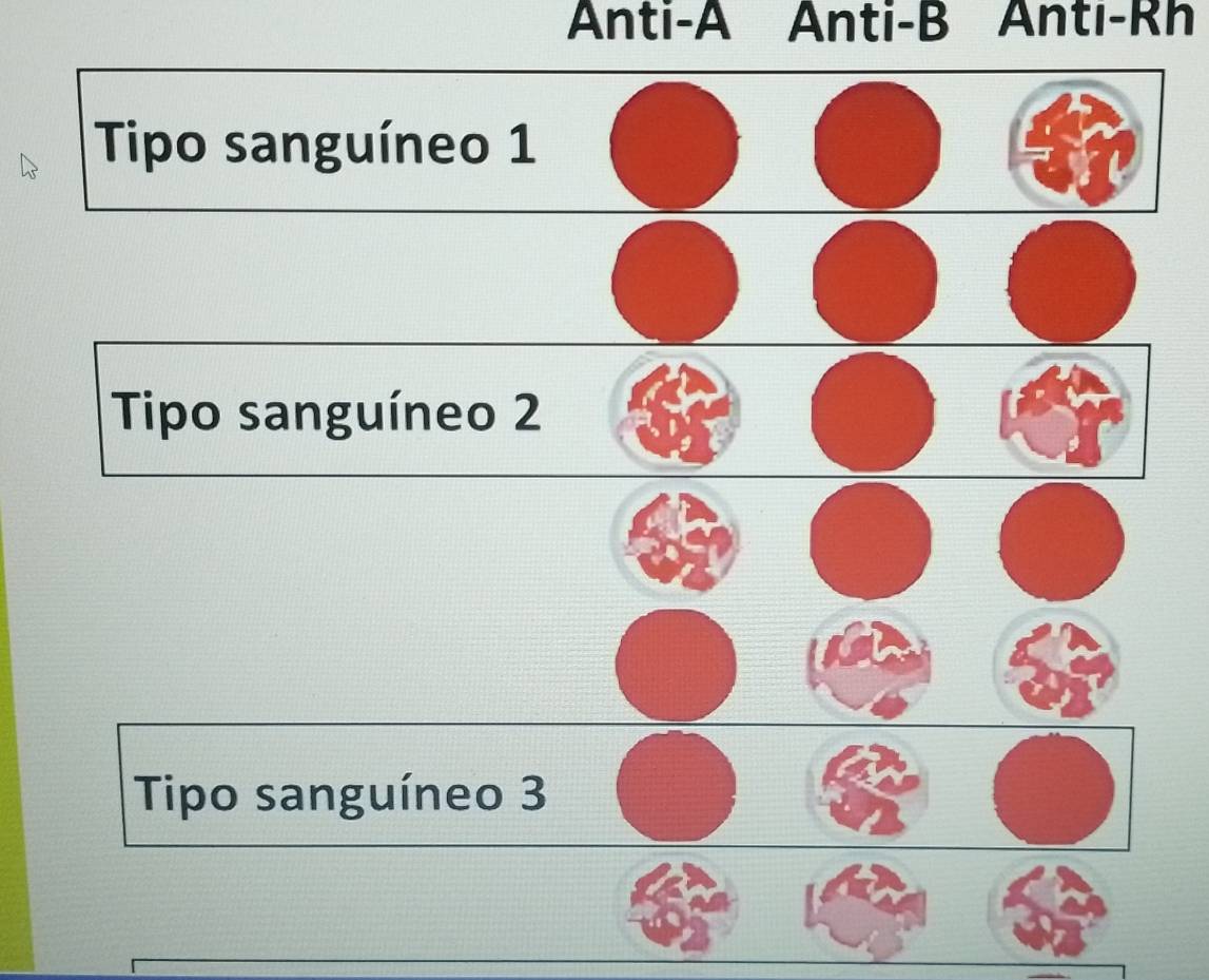 Anti-A Anti-B Antı-Rh