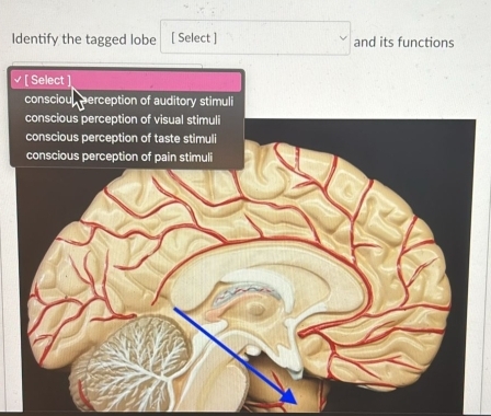 Identify the tagged lobe [ Select ] and its functions 
[ Select