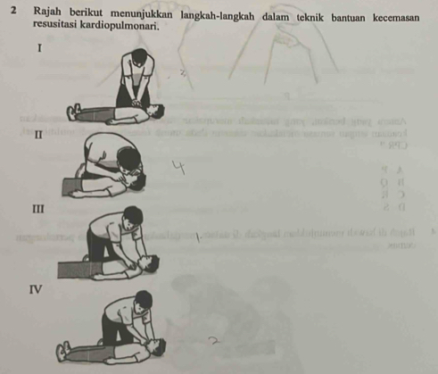 Rajah berikut menunjukkan langkah-langkah dalam teknik bantuan kecemasan
resusitasi kardiopulmonari.
I
I
III
IV