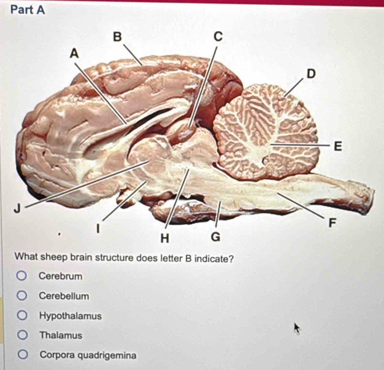 What sheep brain structure does letter B indicate?
Cerebrum
Cerebellum
Hypothalamus
Thalamus
Corpora quadrigemina