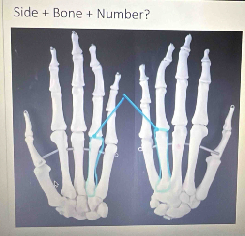 Side + Bone + Number?