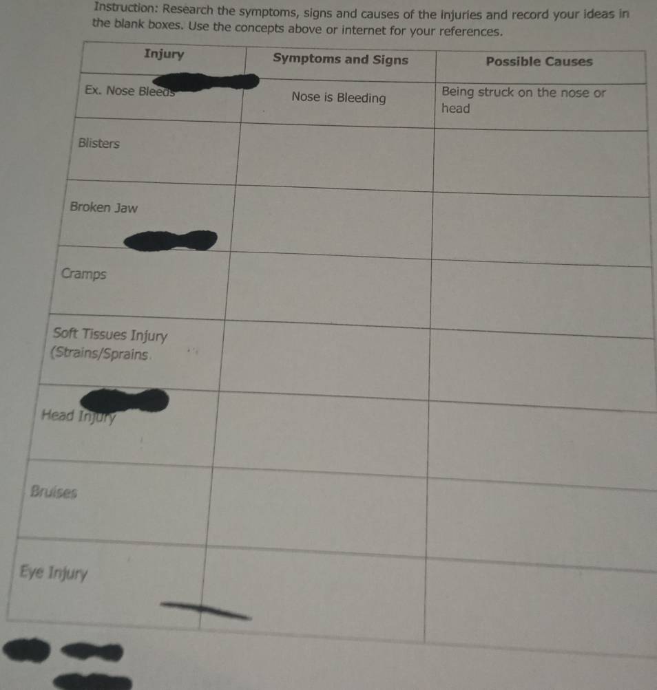 Instruction: Research the symptoms, signs and causes of the injuries and record your ideas in 
the blank boxes. Use the concepts above or internet for your references. 
B 
Ey