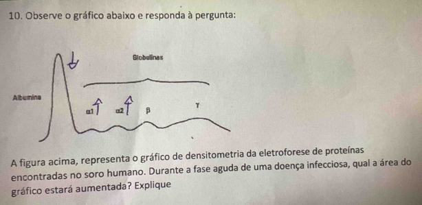 Observe o gráfico abaixo e responda à pergunta: 
A figura acima, representa o gráfico de densitometria da eletroforese de proteínas 
encontradas no soro humano. Durante a fase aguda de uma doença infecciosa, qual a área do 
gráfico estará aumentada? Explique