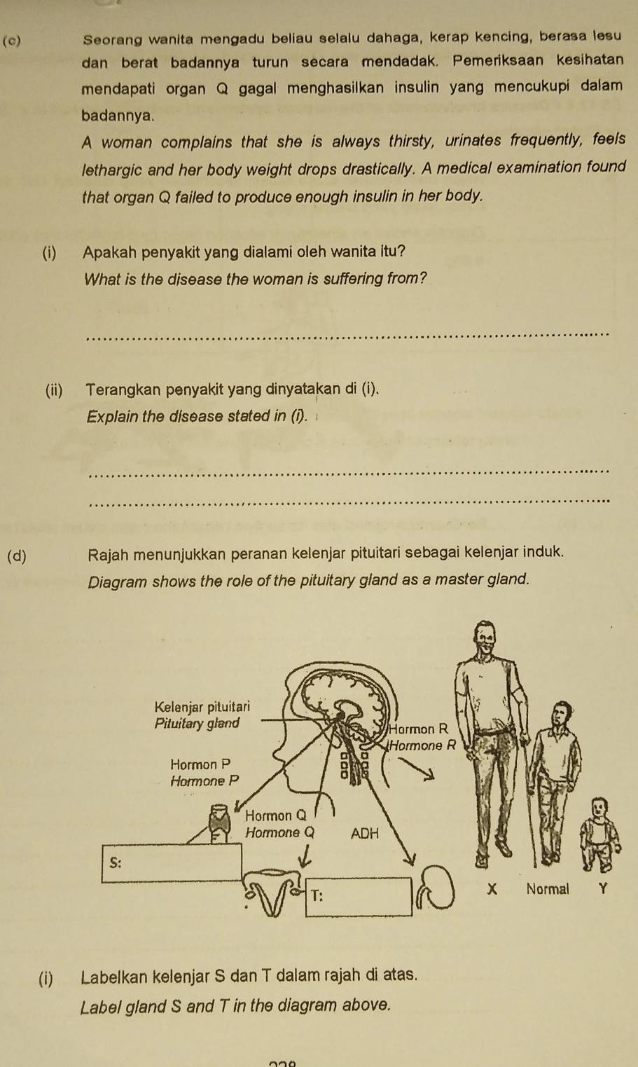 Seorang wanita mengadu beliau selalu dahaga, kerap kencing, berasa lesu 
dan berat badannya turun secara mendadak. Pemeriksaan kesihatan 
mendapati organ Q gagal menghasilkan insulin yang mencukupi dalam 
badannya. 
A woman complains that she is always thirsty, urinates frequently, feels 
lethargic and her body weight drops drastically. A medical examination found 
that organ Q failed to produce enough insulin in her body. 
(i) Apakah penyakit yang dialami oleh wanita itu? 
What is the disease the woman is suffering from? 
_ 
(ii) Terangkan penyakit yang dinyatakan di (i). 
Explain the disease stated in (i). 
_ 
_ 
(d) Rajah menunjukkan peranan kelenjar pituitari sebagai kelenjar induk. 
Diagram shows the role of the pituitary gland as a master gland. 
(i) Labelkan kelenjar S dan T dalam rajah di atas. 
Label gland S and T in the diagram above.