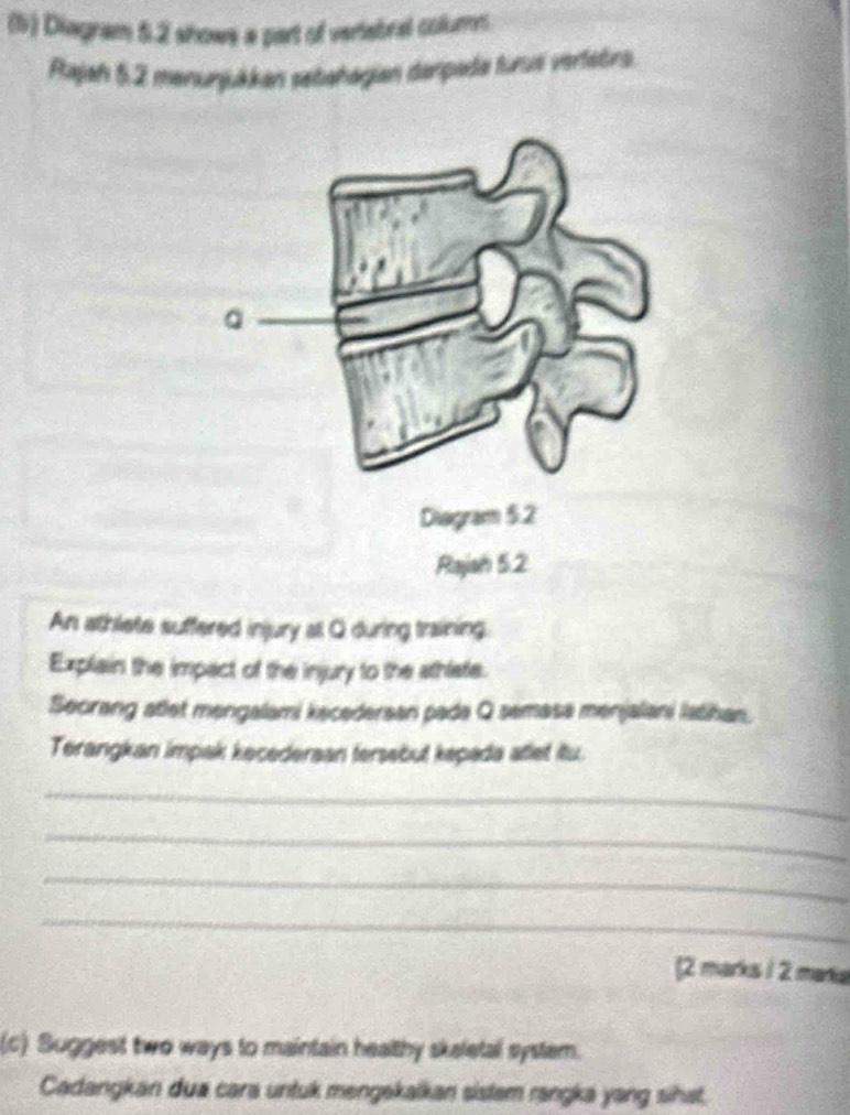 (5) Diagram 5.2 shows a part of vertebral colums 
Pajah 5.2 menurjukkan sebəñagian darpada turus vertatina. 
An athlete suffered injury all Q during training. 
Explain the impact of the injury to the athlate. 
Seorang atlet mengalami kecedersan pada Q semasa menjalani latihan. 
Terangkan impak kecederaan tersebut kepada atlet itu. 
_ 
_ 
_ 
_ 
(2 marks 1 2 manka 
(c) Suggest two ways to maintain healthy skaletal system. 
Cadangkan dua cara untuk mengekalkan sistem rangka yang sihst.