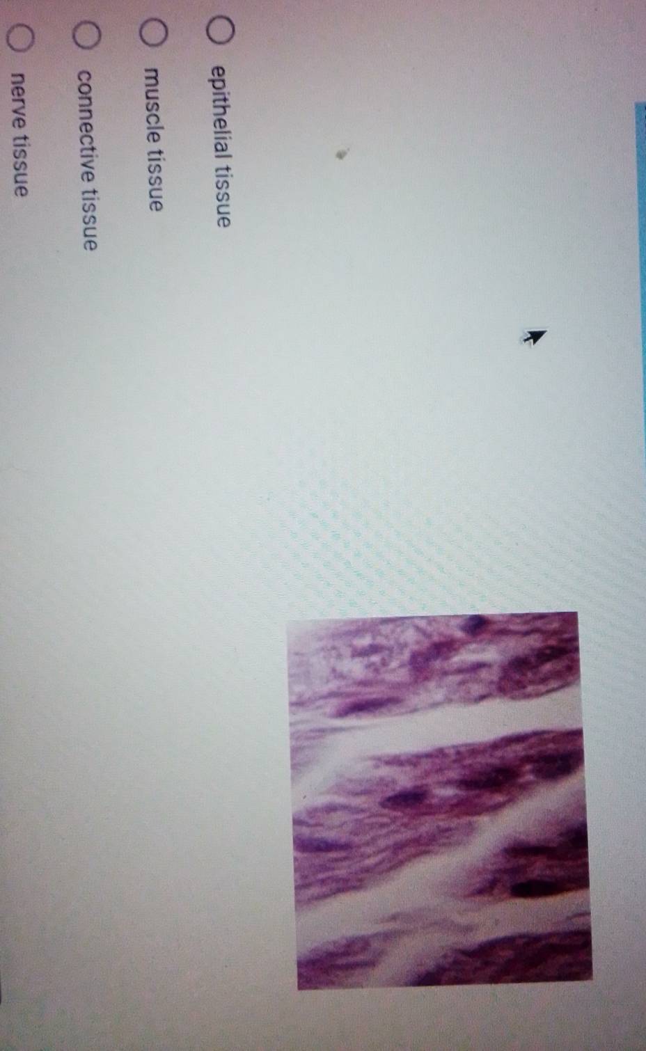 epithelial tissue
muscle tissue
connective tissue
nerve tissue