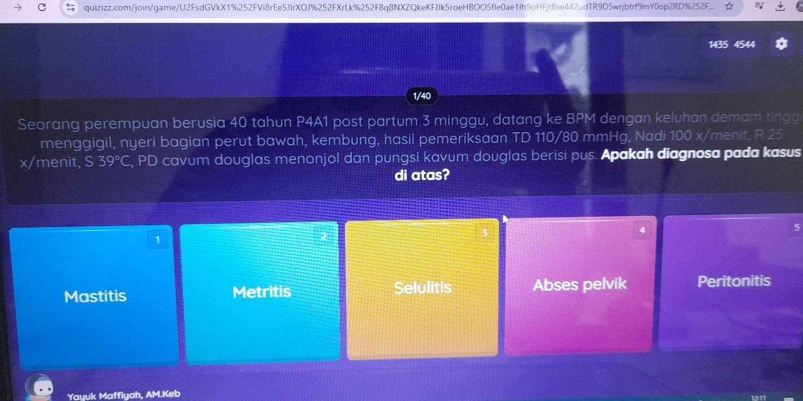 quizizz.com/join/game/U2FsdGVkX1%252FVi8rEe5JlrXOJ%252FXrLk%252F8q8NXZQkeKFJJk5roeHBOO5fle0ae1Ih9oHFjtBiw442udTR9D5wrjbtrf9mY0op2RD%252F... =
1435 4544
1/40
Seorang perempuan berusia 40 tahun P4A1 post partum 3 minggu, datang ke BPM dengan keluhan demam tingg
menggigil, nyeri bagian perut bawah, kembung, hasil pemeriksaan TD 110/80 mmHg, Nadi 100 x/menit, R 25
x/menit, S 39°C , PD cavum douglas menonjol dan pungsi kavum douglas berisi pus. Apakah diagnosa pada kasus
di atas?
5
1
Selulitis
Mastitis Metritis Abses pelvik
Peritonitis
Yayuk Maffiyah, AM.Keb
12:11