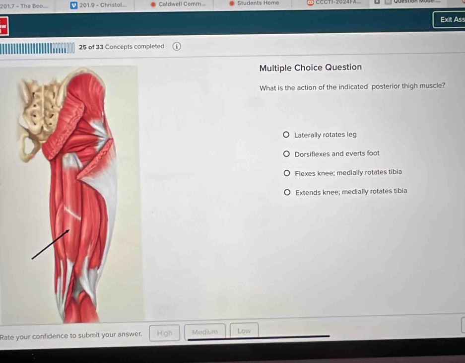 201.7 - The Boo... 201.9 - Christol... Caldwell Comm... Students Home CCCT-2024FA
Exit Ass
25 of 33 Concepts completed
Multiple Choice Question
What is the action of the indicated posterior thigh muscle?
Laterally rotates leg
Dorsiflexes and everts foot
Flexes knee; medially rotates tibia
Extends knee; medially rotates tibia
Rate your confidence to submit your answer. High Medium Low