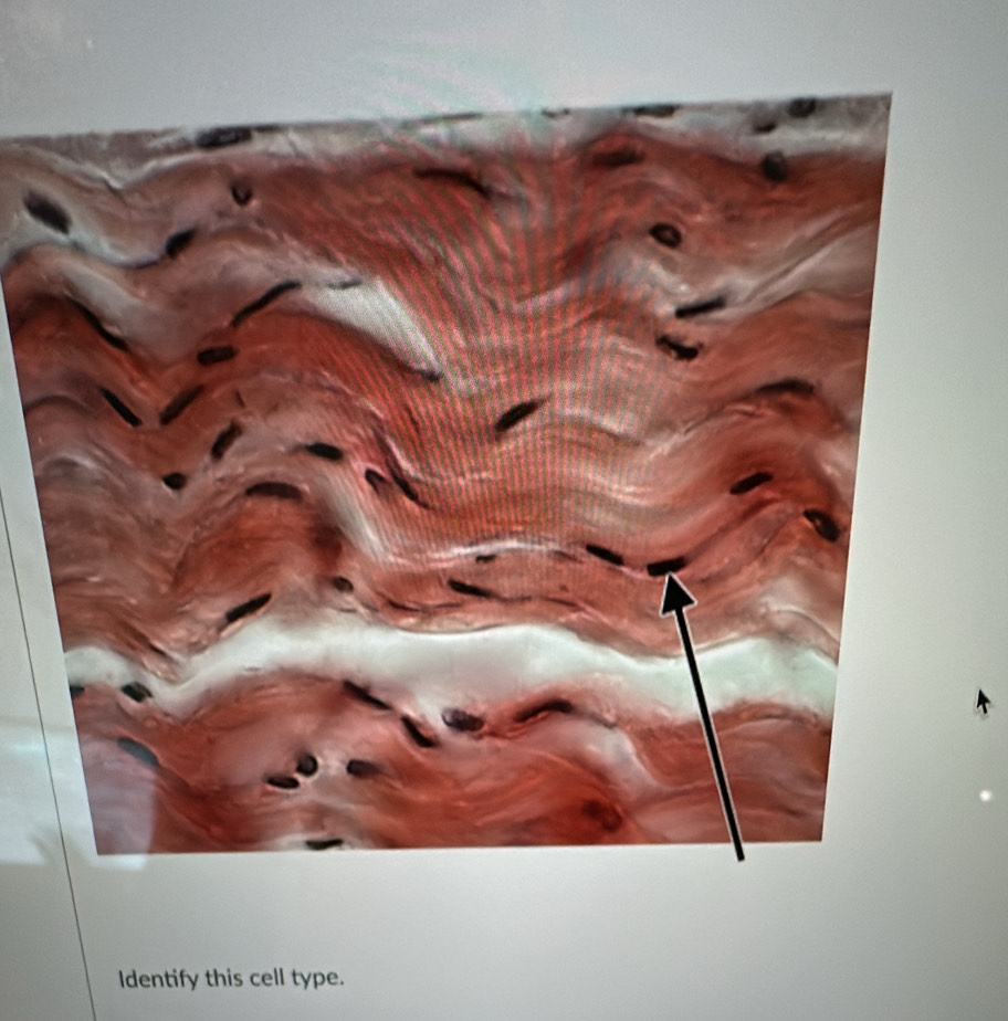 dentify this cell type.