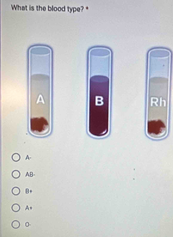 What is the blood type? *
A
B
Rh
A-
AB -
B+
A+
0-