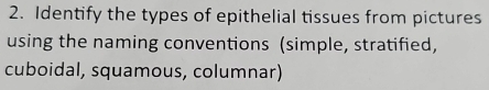 Identify the types of epithelial tissues from pictures 
using the naming conventions (simple, stratified, 
cuboidal, squamous, columnar)