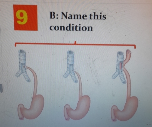 B: Name this 
condition