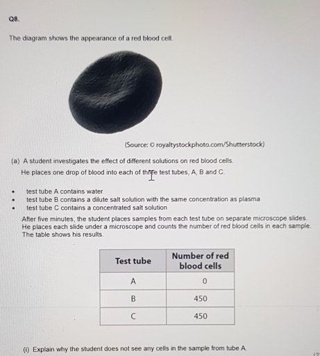 The diagram shows the appearance of a red blood cell. 
(Source: © royaltystockphoto.com/Shutterstock) 
(a) A student investigates the effect of different solutions on red blood cells. 
He places one drop of blood into each of three test tubes, A, B and C. 
test tube A contains wate 
test tube B contains a dilute salt solution with the same concentration as plasma 
test tube C contains a concentrated salt solution 
After five minutes, the student places samples from each test tube on separate microscope slides. 
He places each slide under a microscope and counts the number of red blood cells in each sample. 
The table shows his results. 
(i) Explain why the student does not see any cells in the sample from tube A. 
12