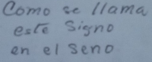 como se llama 
este Signo 
en el seno