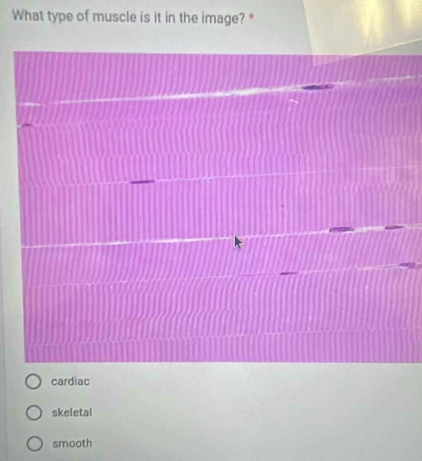 What type of muscle is it in the image? *
cardiac
skeletal
smooth